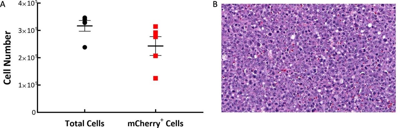 图1:C57BL/6小鼠C1498-Luc-mCherry肿瘤组成。答:肿瘤大多由mCherry+细胞组成。B:典型的h&e染色显示肿瘤细胞具有多形性核和多个有丝分裂像，原镜放大20倍。