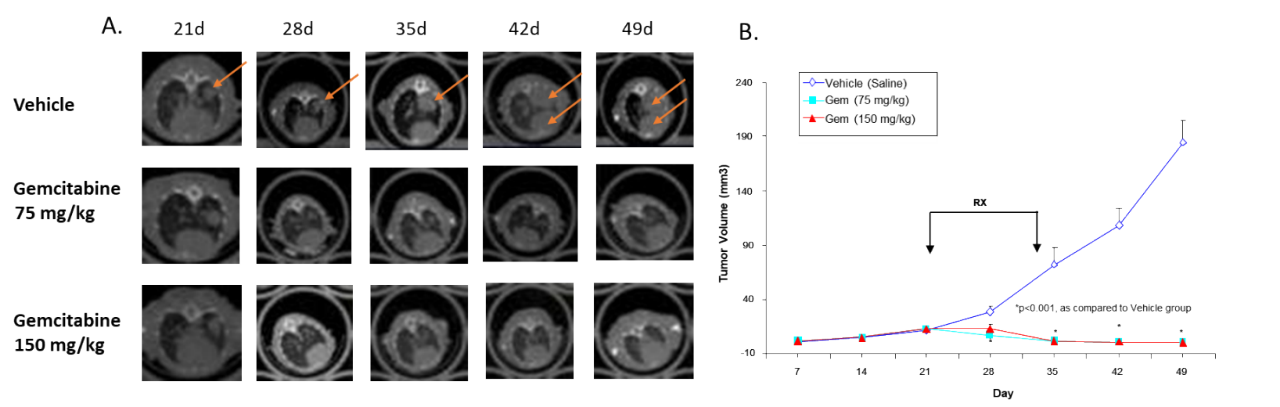 图4:吉西他滨对OT植入裸鼠体内的人非小细胞肺腺癌H441的影响。A.具有代表性的纵向图像。B.肿瘤体积的量化。