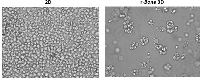 图1:U266B1人骨髓瘤细胞的2D与重建骨(r-Bone) 3D培养